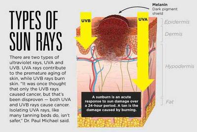 What S Happening Below The Surface Of Your Sunburn Southern Hills Hospital Medical Center