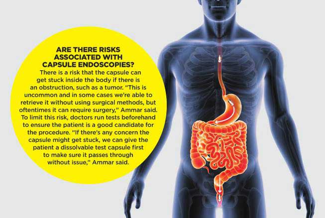 gastritis-symptoms-infographic-a-digestive-system-disease-cartoon