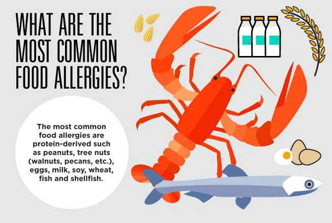 What You Need to Know About Food Allergies | Southern Hills Hospital ...